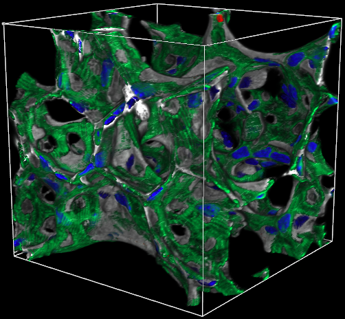 Healthy Alveoli