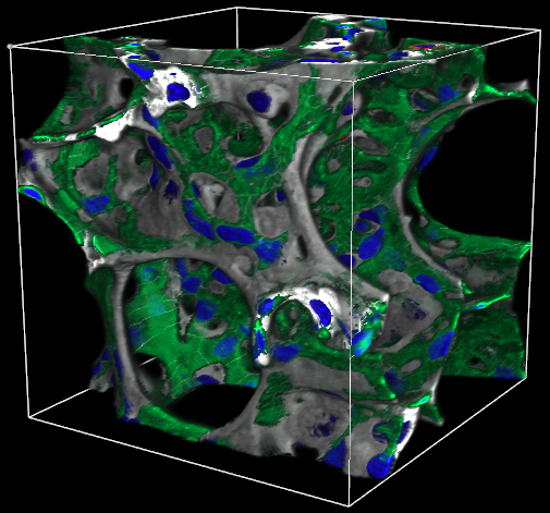 KMC 1 Merged