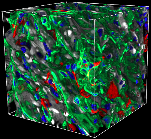 KMC 2 Merged