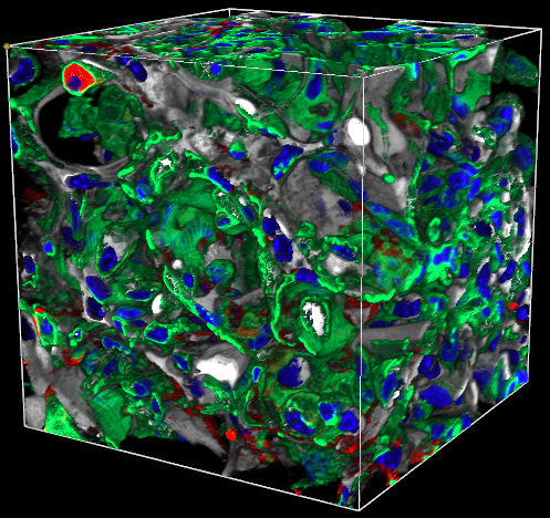 KMC 3 Merged