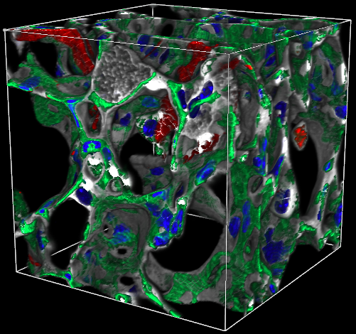 KMC 1 Merged