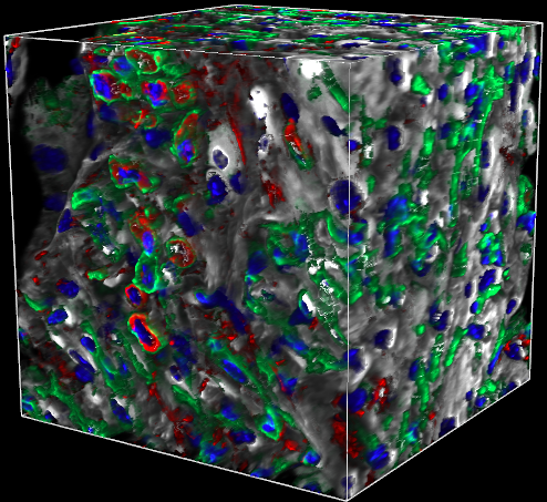 KMC 3 Merged