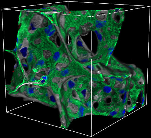 KMC 1 Merged