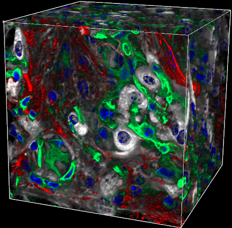 KMC 2 Merged