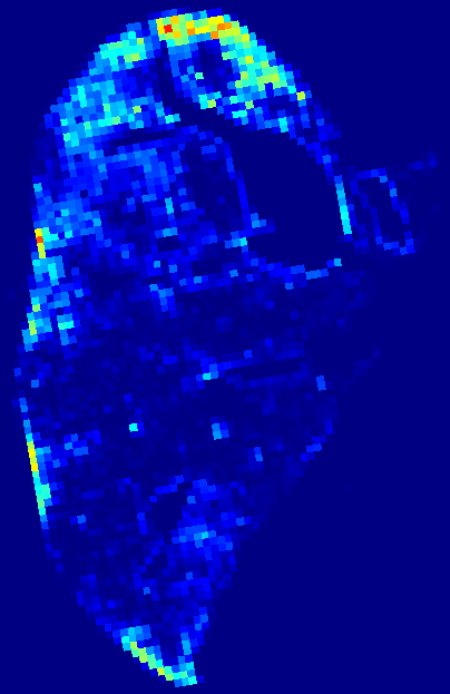 Week 2 aSMA heatmap