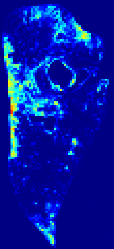 Week 3 aSMA heatmap