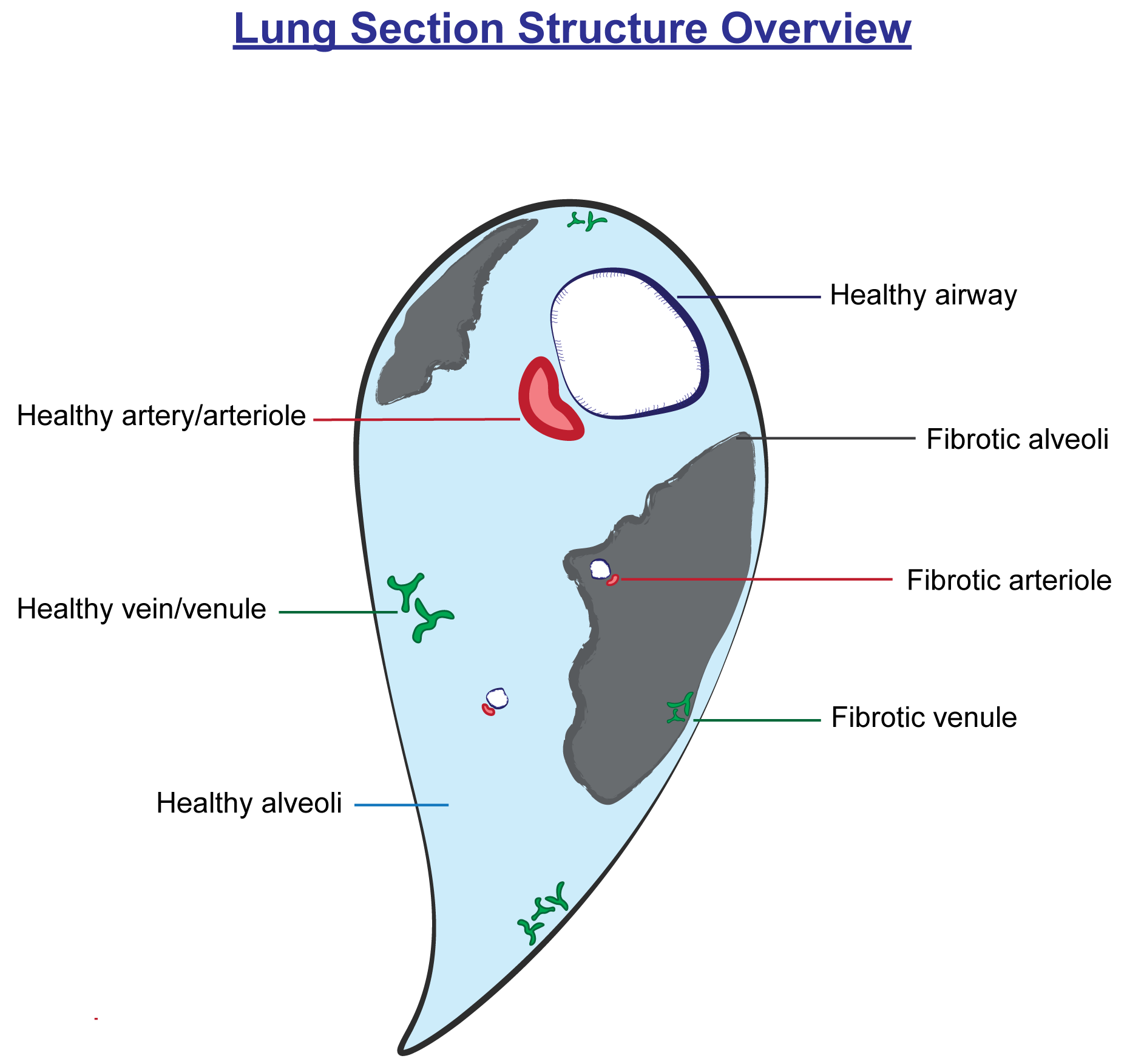 Lung Section Structure Overview