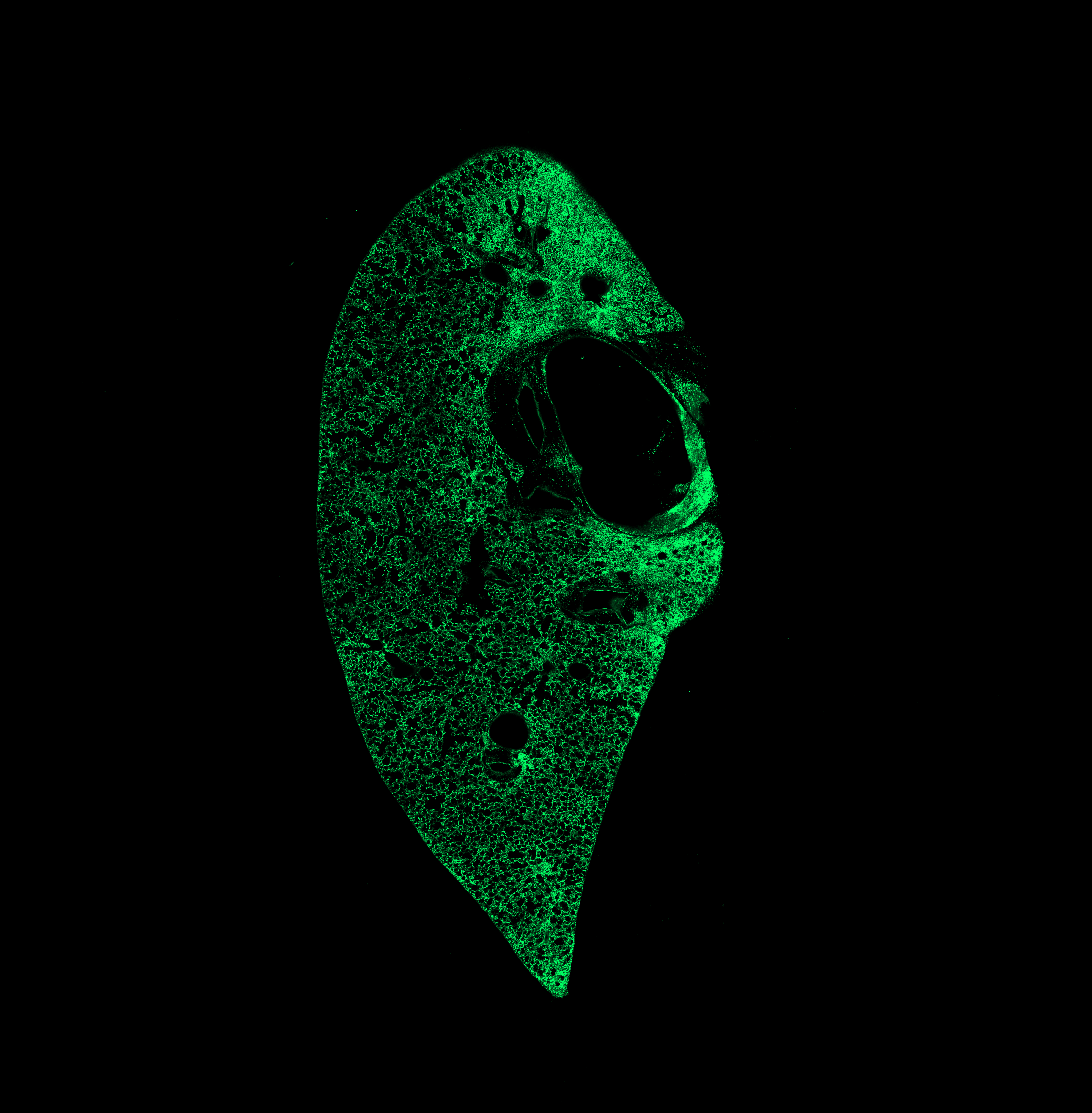 Week 1 GFP channel