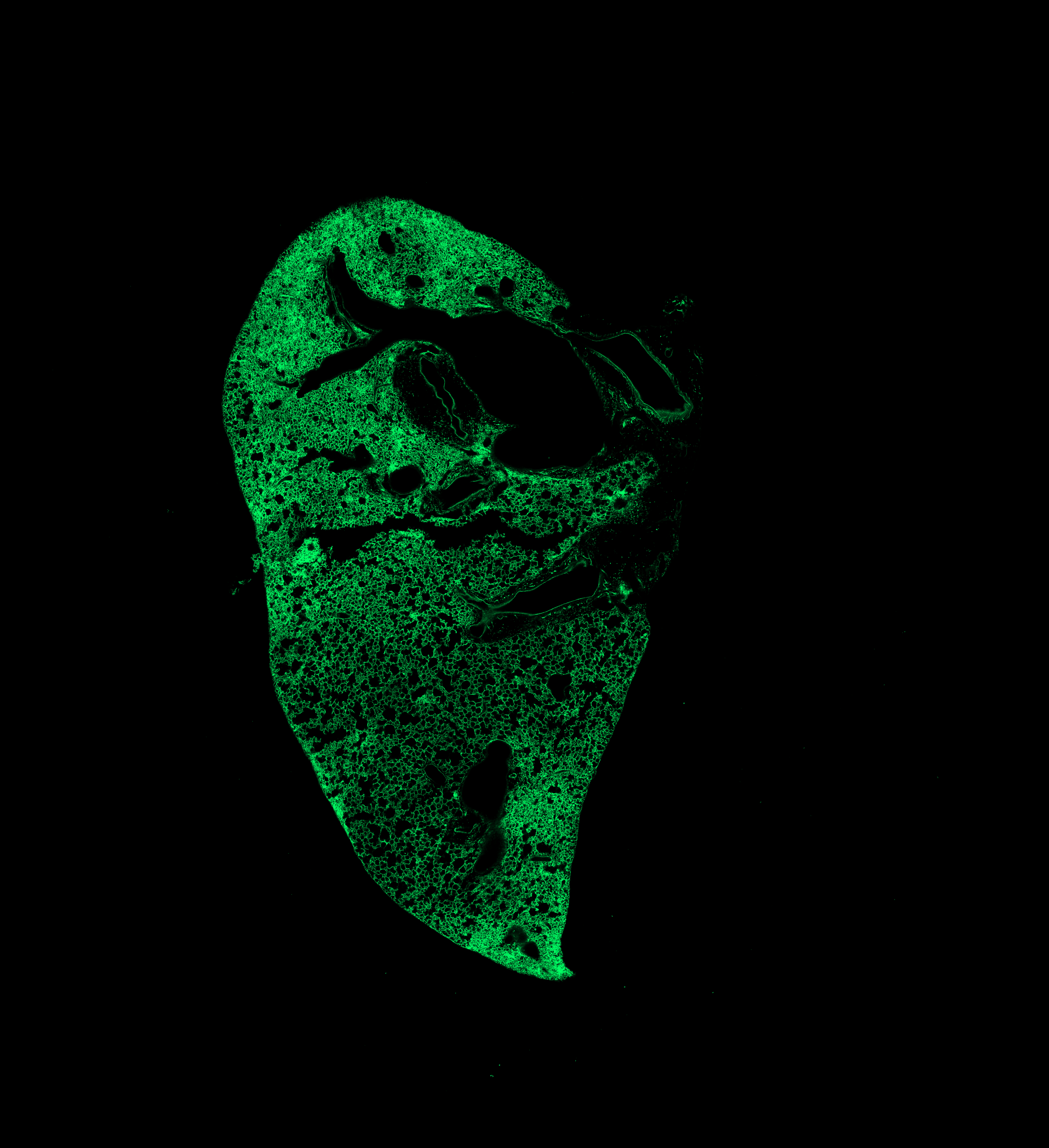 Week 2 GFP channel