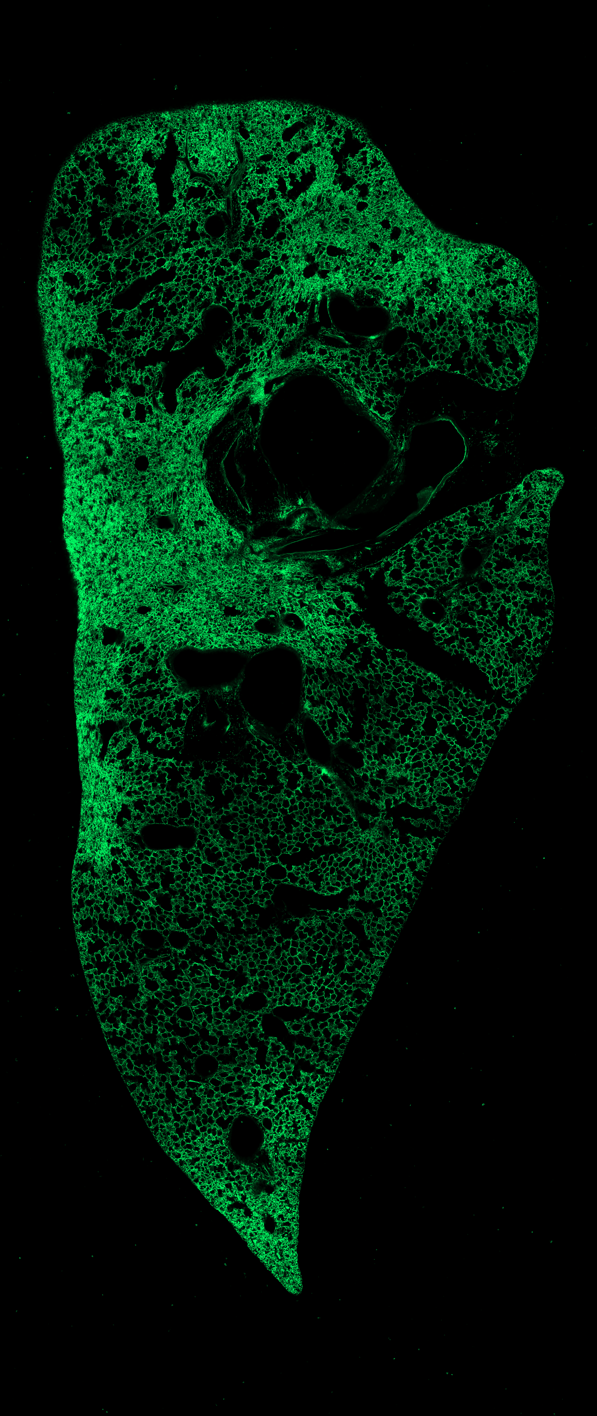 Week 3 GFP channel