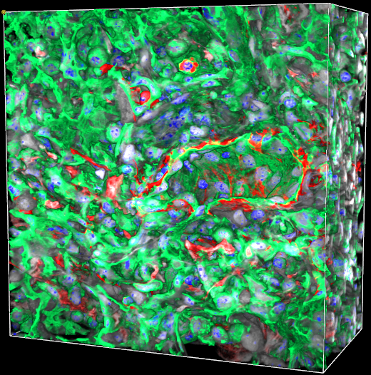 Fibrotic Venule Merged