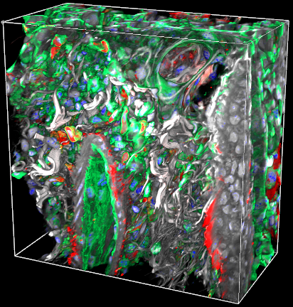 Fibrotic Arteriole Merged