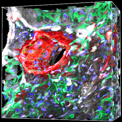 Fibrotic Arteriole Merged