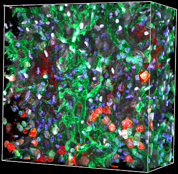 Fibrotic Venule Merged